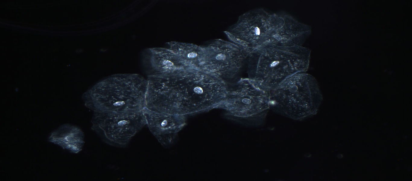 mrna-for-new